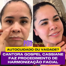 Cassiane surpreende seguidores com transformação estética aos 52 anos