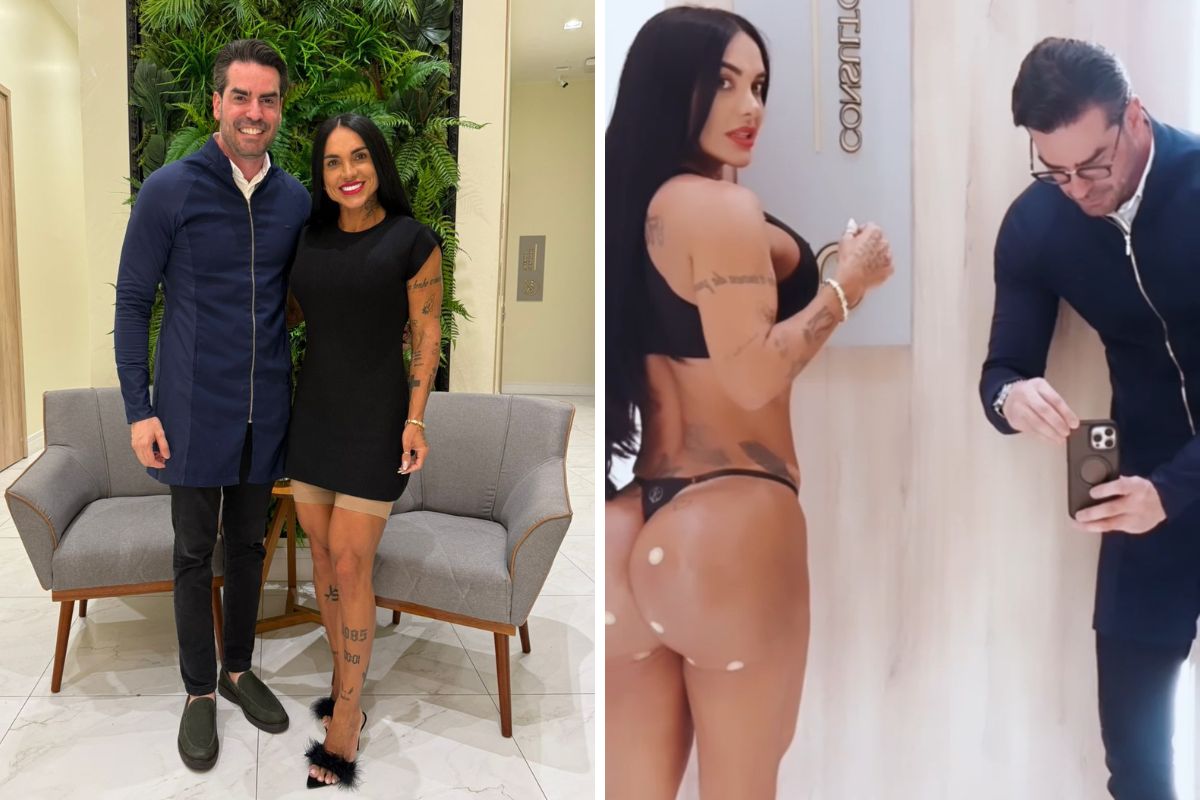 Kamila Simioni corrige assimetria no bumbum após uso de hidrogel