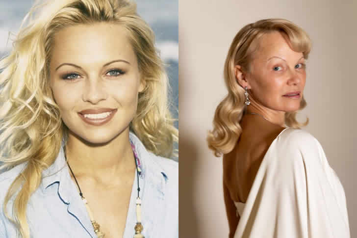 PAMELA ANDERSON – USO DE DROGAS E NOVO CAPÍTULO