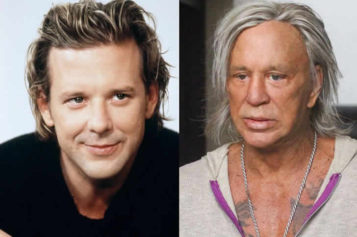 MICKEY ROURKE – BOXING E CIRURGIAS