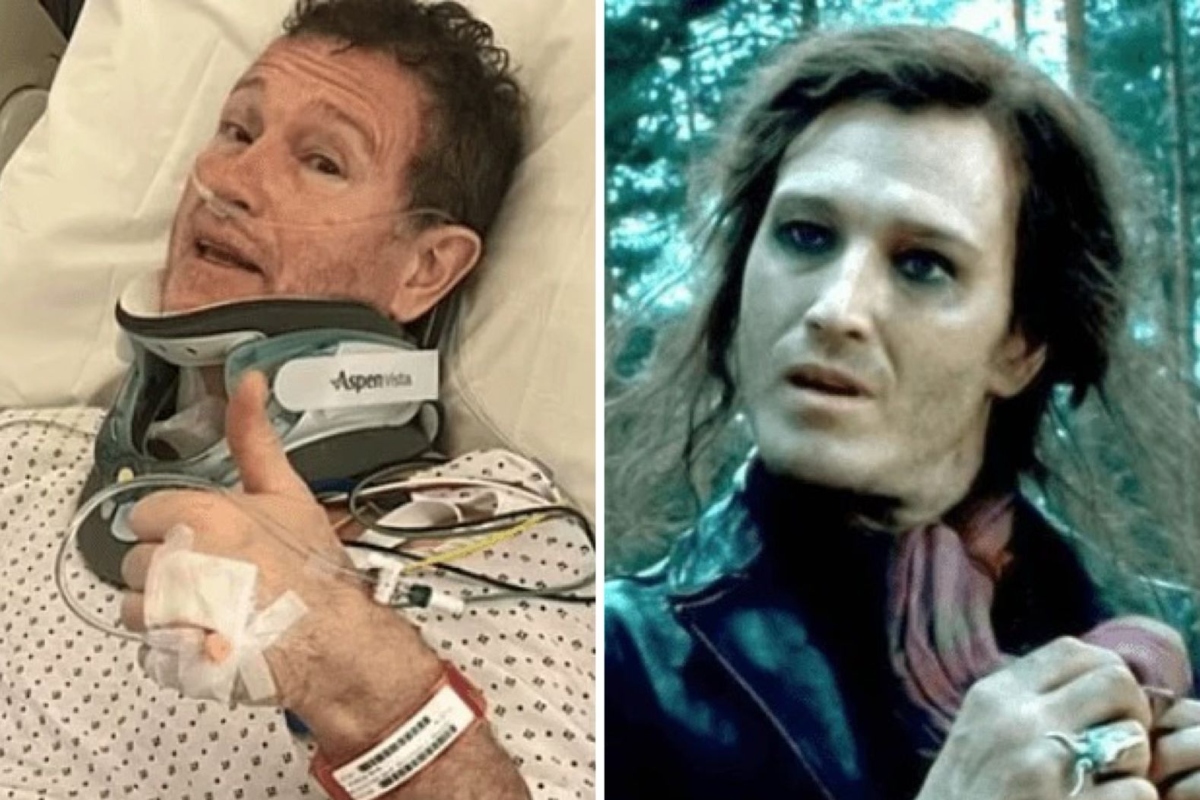 Nick Moran, ator de ‘Harry Potter’, pode perder os movimentos