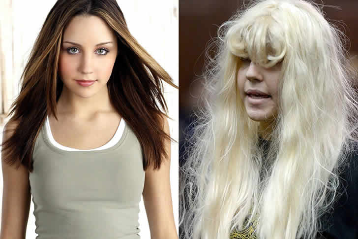 Você Vai se Surpreender: O Antes e Depois de Famosos que Mudaram Demais AMANDA BYNES – USO DE DROGAS